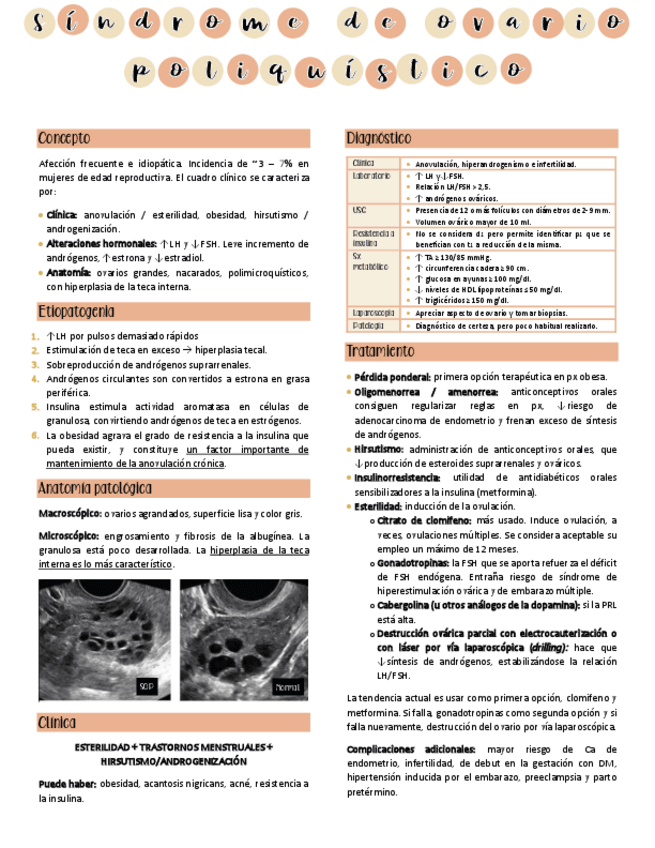 Miniatura del documento Sindrome-de-ovario-poliquistico.pdf