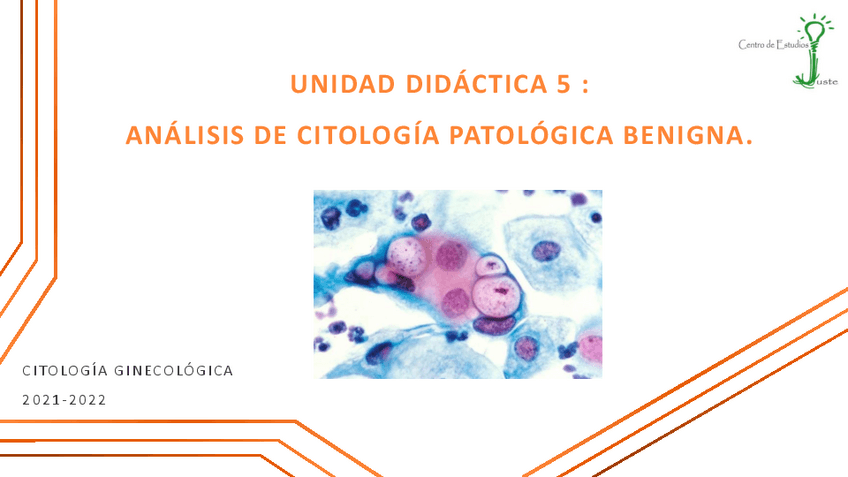 Miniatura del documento U5-AnalisisCitologiaPatologicaBenigna-21-22.pdf