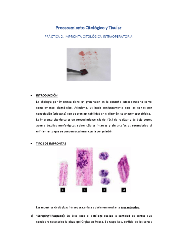 Miniatura del documento PrActica-2-Impronta-citolAgica-intraoperatoria.pdf