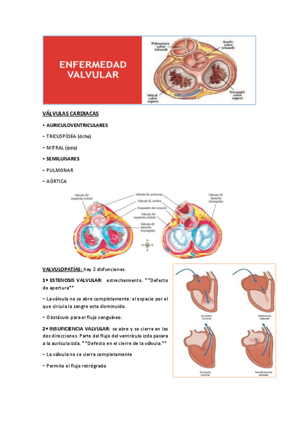 Miniatura del documento VALVULAS-CARDIACAS.pdf
