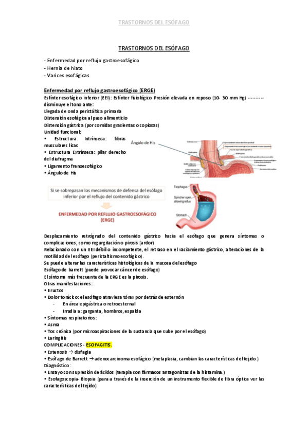 Miniatura del documento TRASTORNOS-DEL-ESOFAGO.pdf
