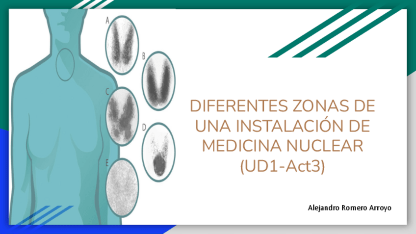 Miniatura del documento DIFERENTES-ZONAS-DE-UNA-INSTALACION-DE-MEDICINA-NUCLEAR-UD1-Act3.pdf