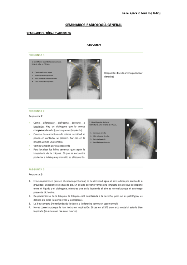 Miniatura del documento Seminarios-radiologia-copia-wuolah.pdf