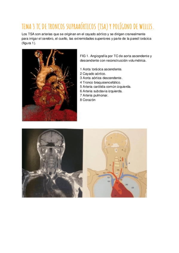 Miniatura del documento TEMA-3-TC-DE-TRONCOS-SUPRAAORTICOS-Y-POLIGONO-DE-WILLIS.pdf