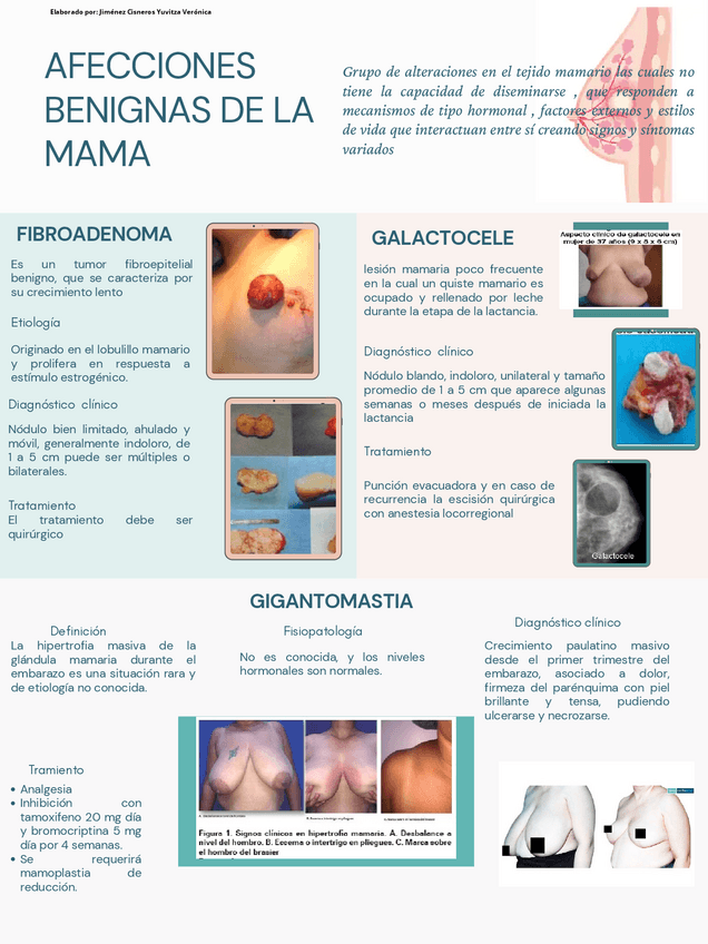 Miniatura del documento Enfermedades-de-la-mama.pdf