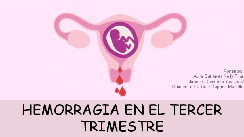 Miniatura del documento Hemorragia-en-el-tercer-trimestre.pdf
