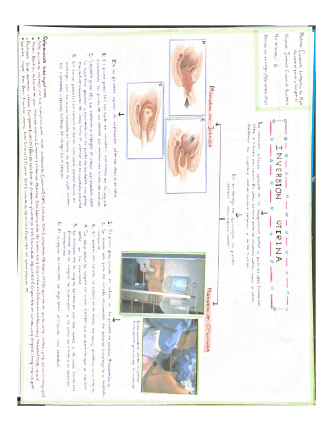 Miniatura del documento Inversion-uterina.pdf