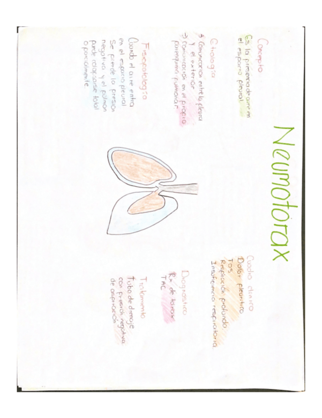 Miniatura del documento Neumotorax-EPOC-.pdf