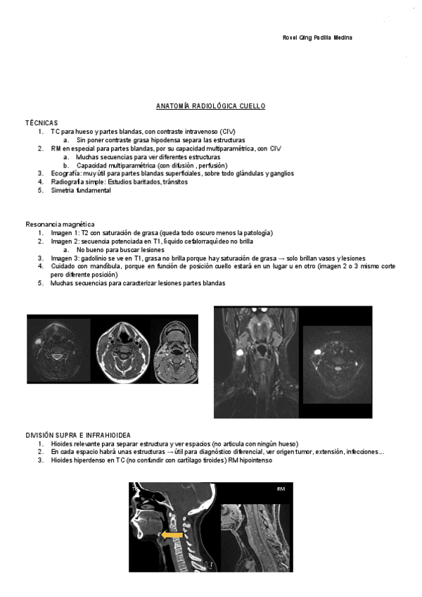 Miniatura del documento ANATOMIA-RADIOLOGICA-CUELLO-Documentos-de-Google.pdf