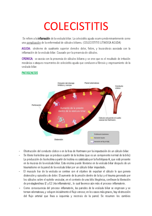 Miniatura del documento COLECISTITIS-I.pdf
