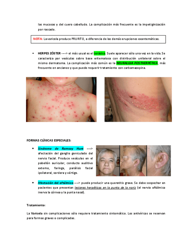 Miniatura del documento HERPES-ZOSTER.pdf