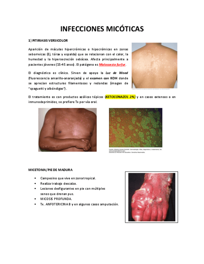 Miniatura del documento INFECCIONES-MICOTICAS.pdf