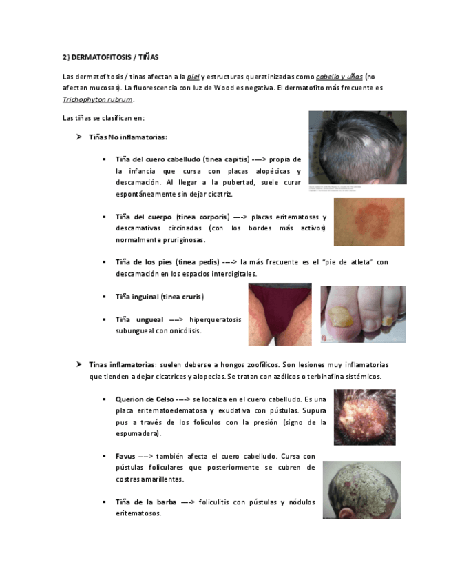 Miniatura del documento DERMATOFITOSIS-TINAS.pdf