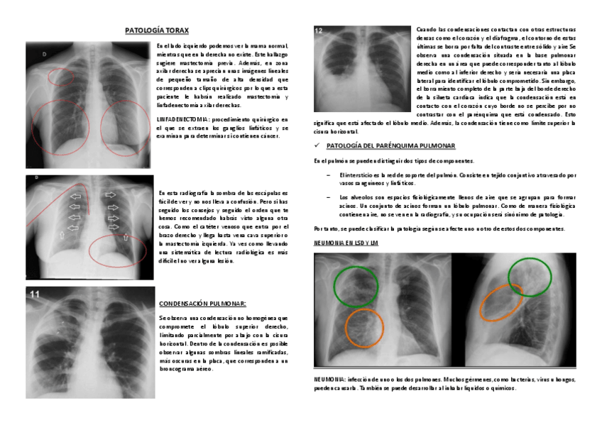 Miniatura del documento PatologiaTorax.pdf