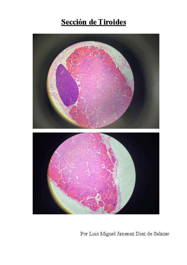 Miniatura del documento Seccion-de-Tiroides-acabado.pdf