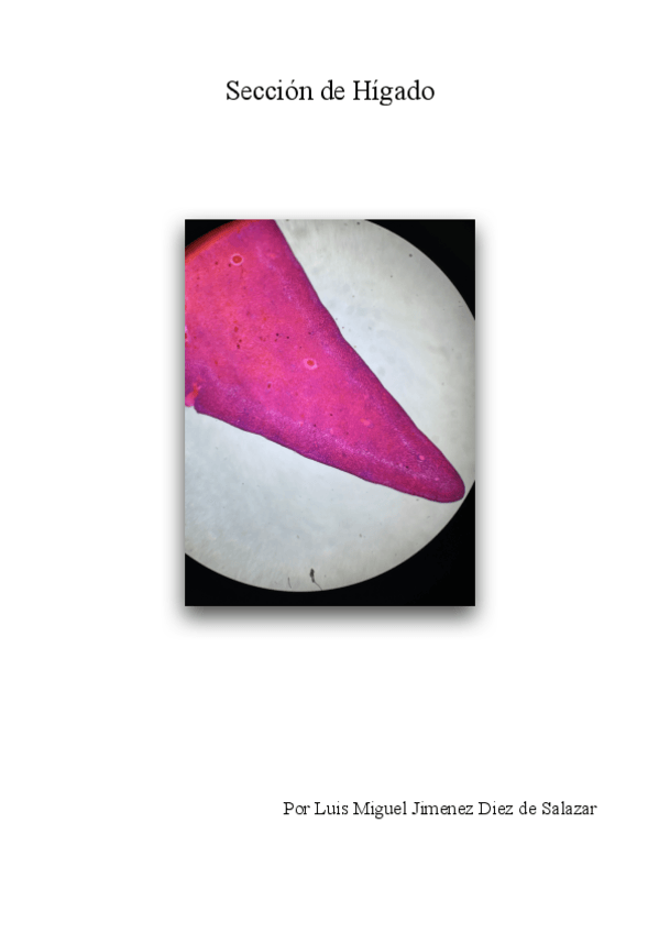 Miniatura del documento Seccion-de-Higado-definiitivo.pdf
