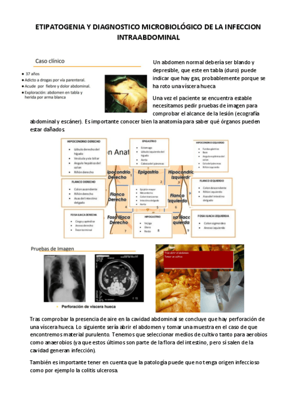 Miniatura del documento ETIPATOGENIA-Y-DIAGNOSTICO-MICROBIOLOGICO-DE-LA-INFECCION-INTRAABDOMINAL.pdf
