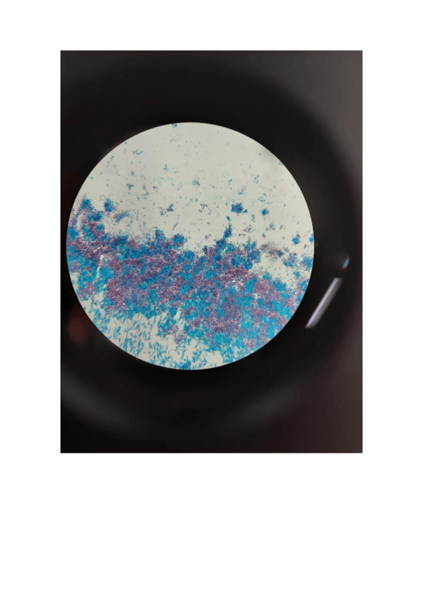 Miniatura del documento FOTOS PRÁCTICA 1 HONGOS