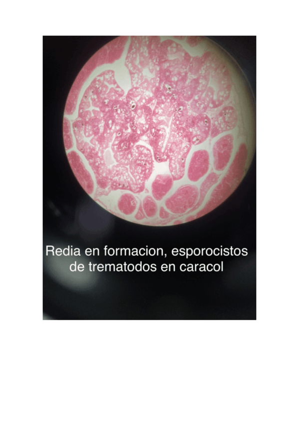 Miniatura del documento FOTOS PRÁCTICA3 ACELOMADO PSEUDOCELOMADO