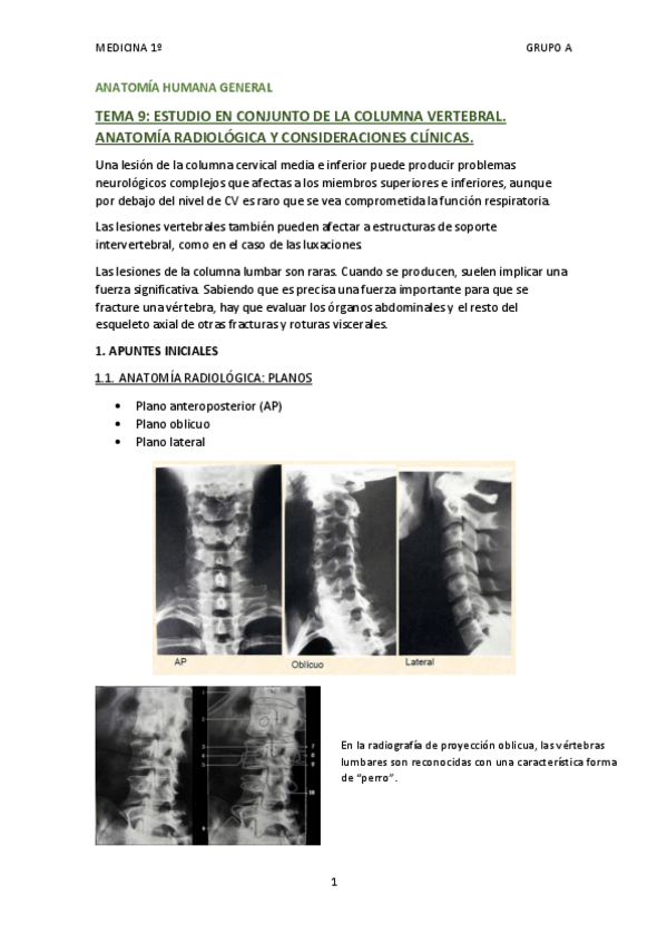 Miniatura del documento TEMA 9 - ESTUDIO EN CONJUNTO DE LA COLUMNA VERTEBRAL.pdf