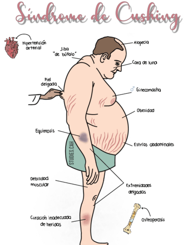 Miniatura del documento sx-de-Cushing-.pdf