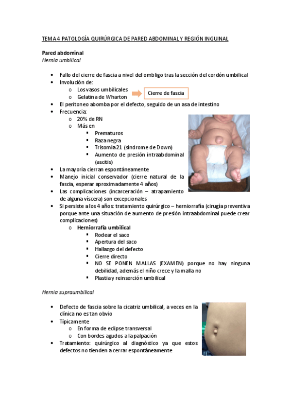 Miniatura del documento T4-Patologia-quirurgica-de-pared-abdominal-y-region-inguinal.pdf
