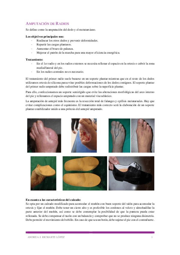 Miniatura del documento Amputacion-de-Radios.pdf