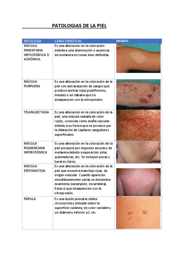 Miniatura del documento tabla-patologias-piel.pdf