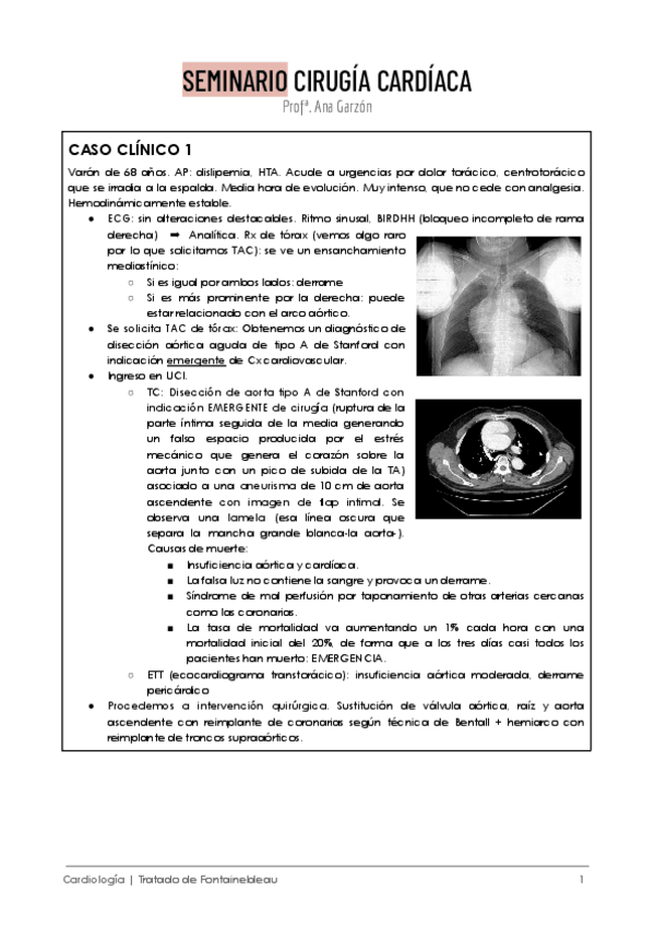 Miniatura del documento SEMINARIO-LUNES-CIRUGIA-CARDIACA.pdf