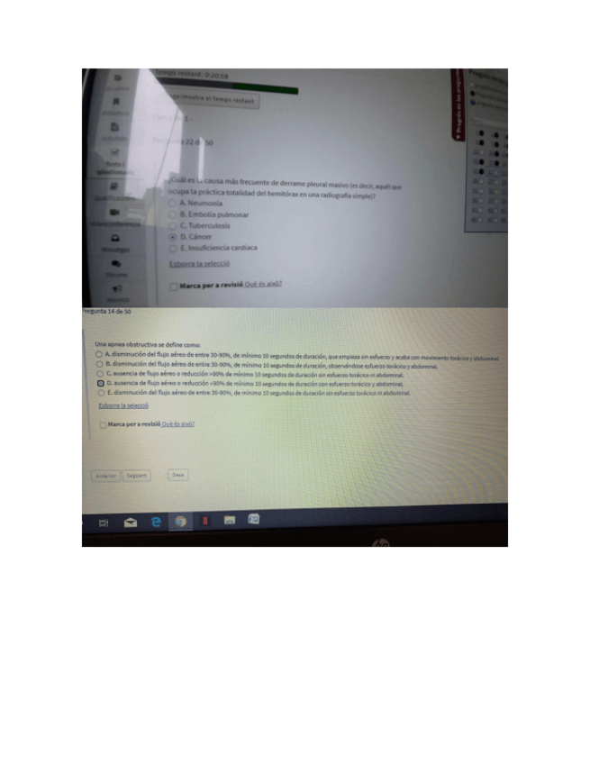 Miniatura del documento examen-respi.pdf