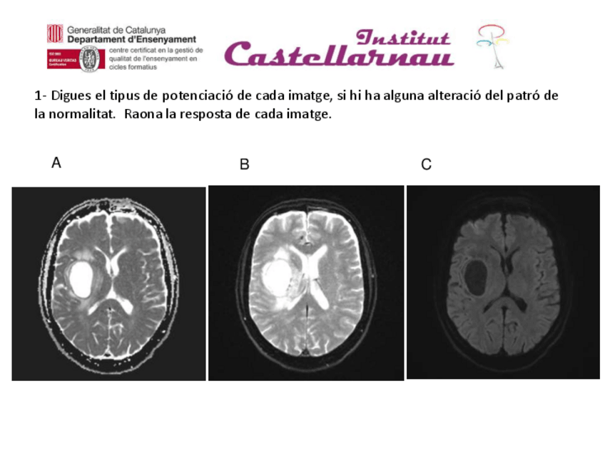 Miniatura del documento Examen-Angio-difu-22.pdf