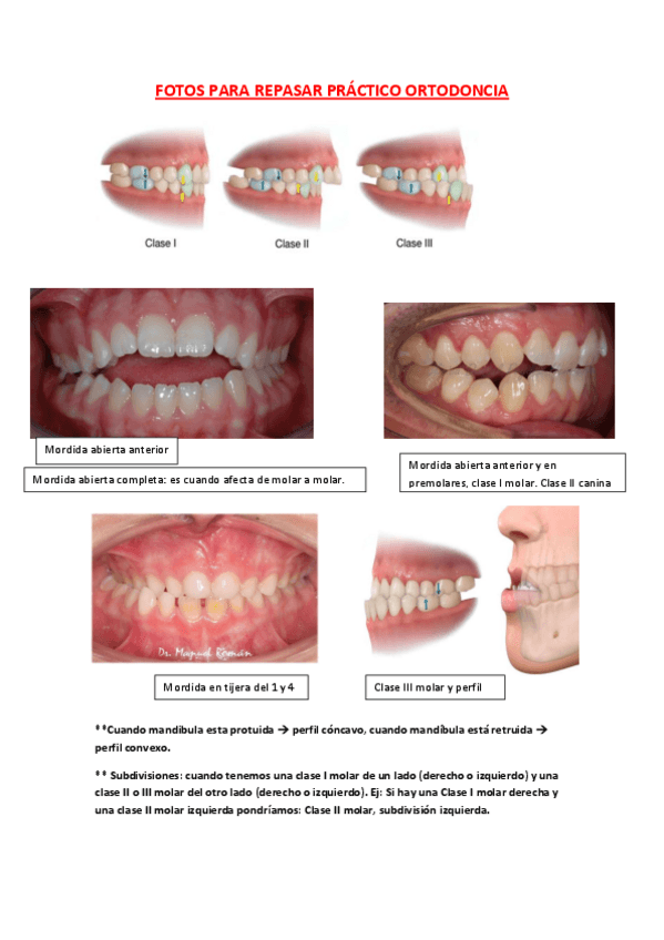 Miniatura del documento FOTOS-PARA-REPASAR-PRACTICO-ORTODONCIA.pdf