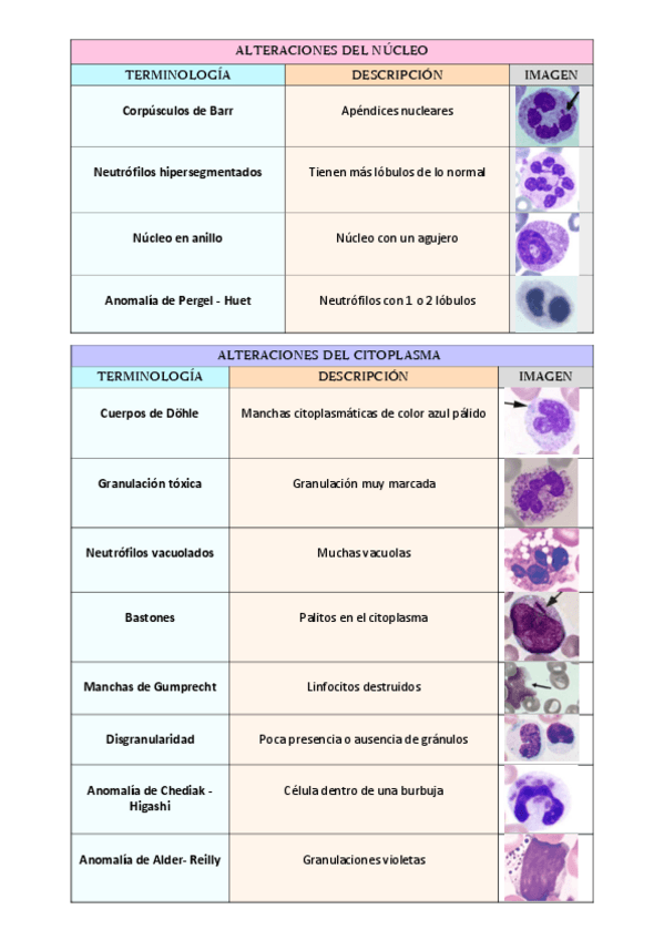 Miniatura del documento Anomalias-de-leucocitos.pdf