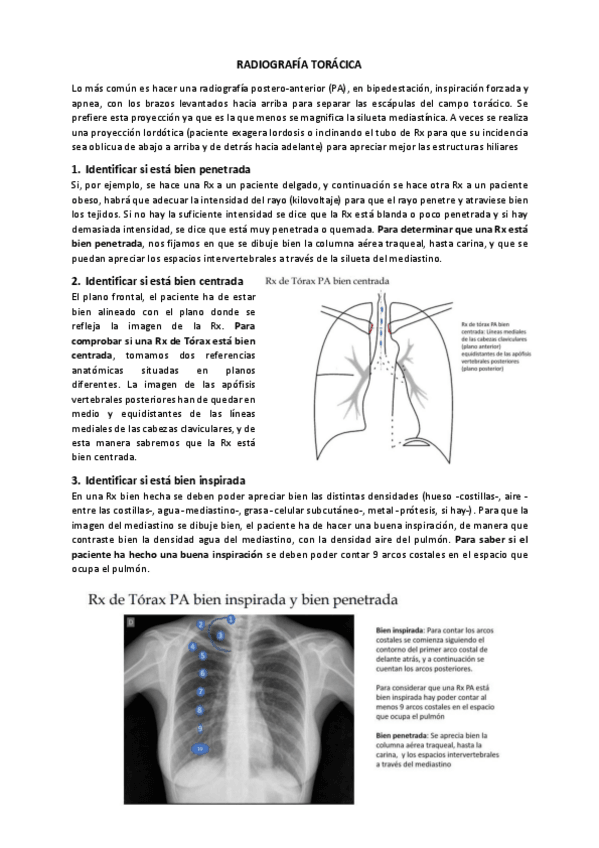 Miniatura del documento radiografiatoracica.pdf