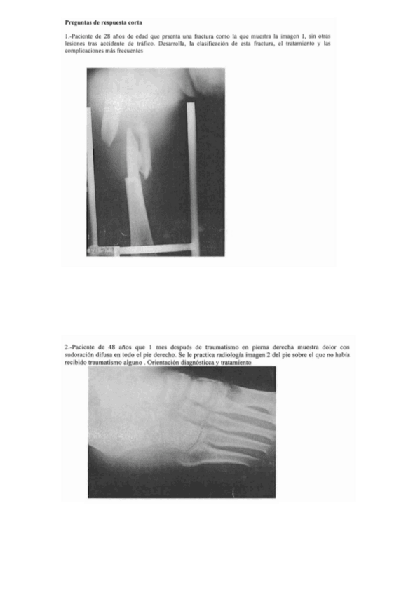 Miniatura del documento MIC1-1P-RECOPILATORI-CASOS.pdf