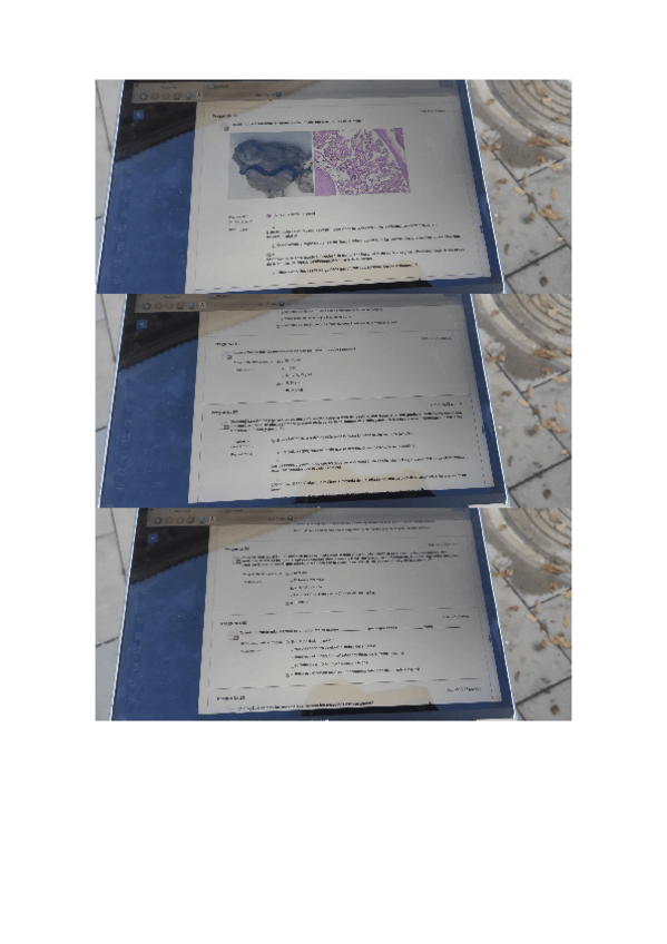 Miniatura del documento examen-sistema-nervioso-diciembre-2022.docx