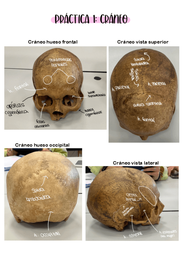 Miniatura del documento Apuntes-Practicas-Anatomia-.pdf