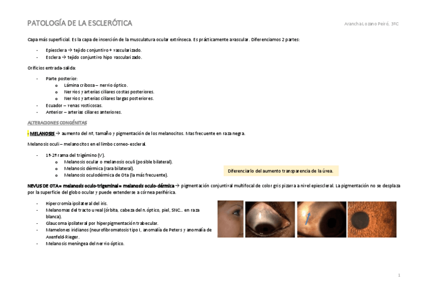 Miniatura del documento T8.-Patologia-de-la-esclerotica.pdf