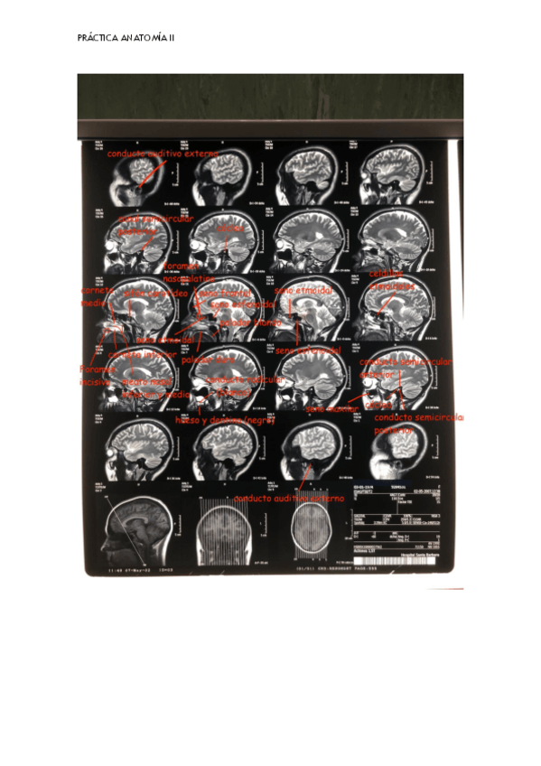 Miniatura del documento radiologicas-oido.pdf