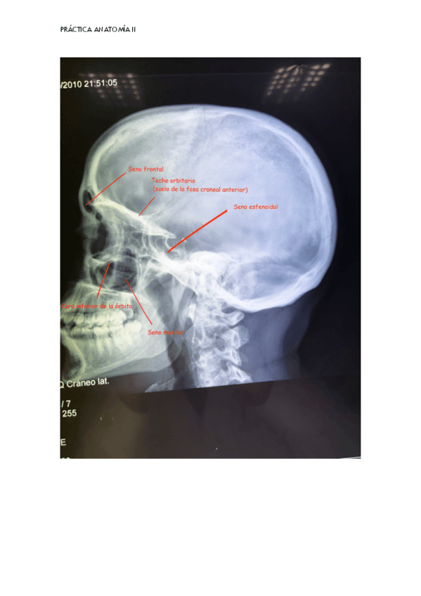Miniatura del documento radiologicas-craneo.pdf