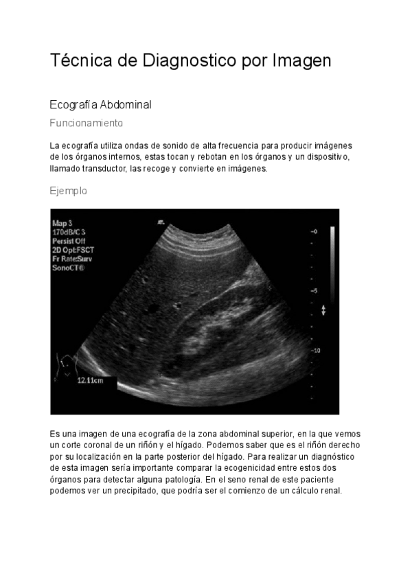 Miniatura del documento Tecnica-de-Diagnostico-por-Imagen-Ecografia-abdominal.pdf