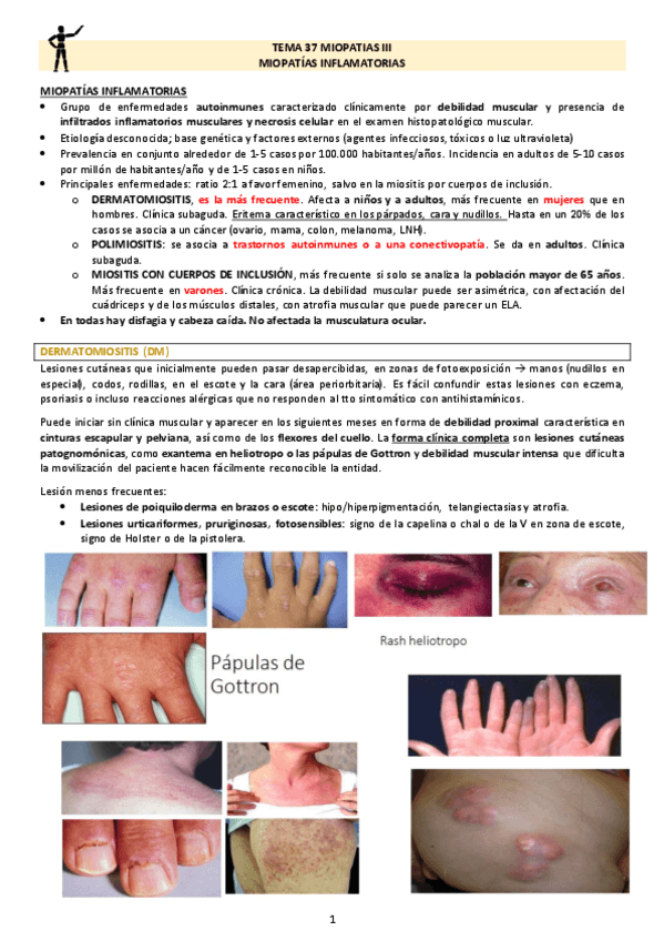 Miniatura del documento TEMA-37-MIOPATIAS-III.pdf