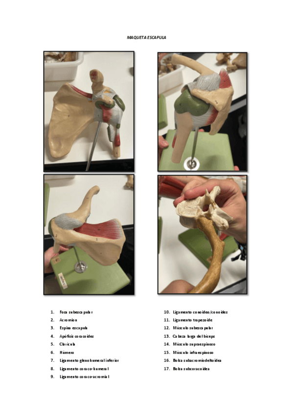 Miniatura del documento MAQUETA-LIGAMENTOS-ESCAPULA-CORREGIDA.pdf