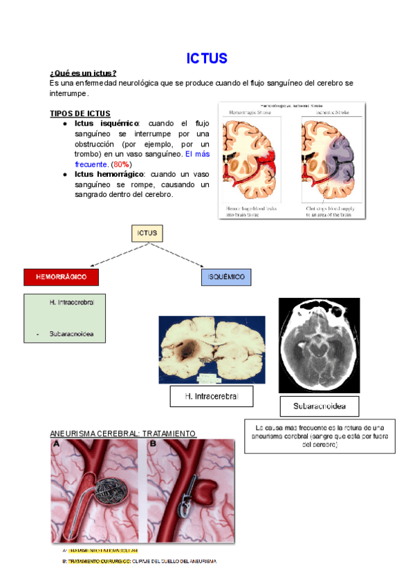Miniatura del documento ICTUS.pdf