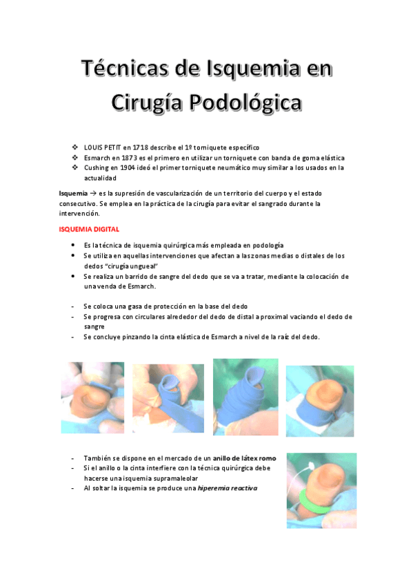 Miniatura del documento Técnicas de Isquemia en Cirugía Podológica.pdf