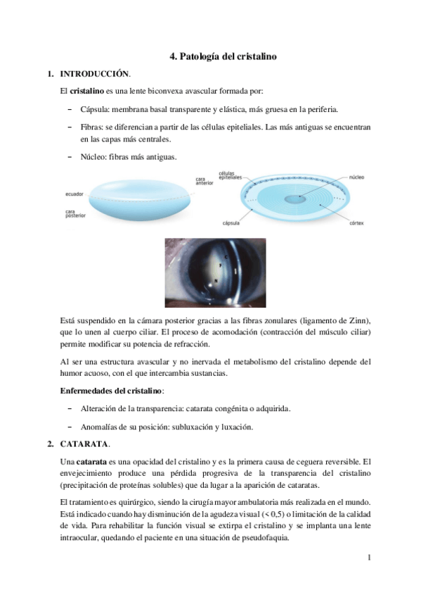 Miniatura del documento 4.-Patologia-del-cristalino.pdf