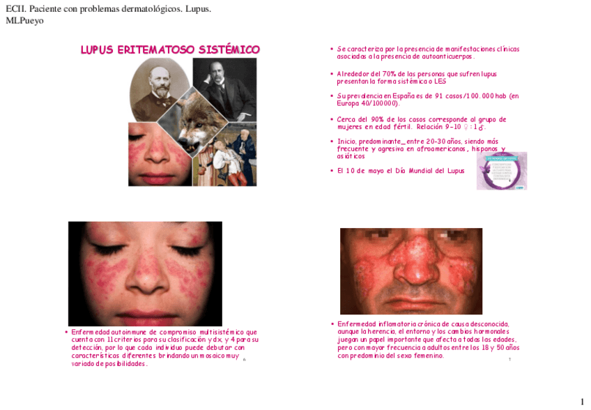 Miniatura del documento 7-PACIENTE-CON-LUPUS.pdf