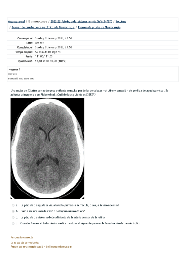 Miniatura del documento Examen-de-prueba-de-Neurocirugia-2022-2023.pdf