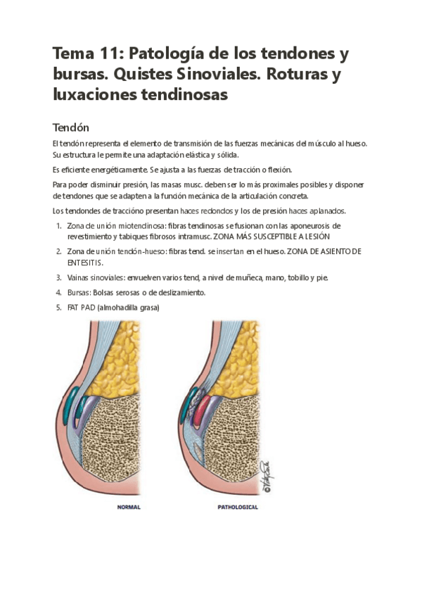 Miniatura del documento Tema-11-Patologia-de-los-tendones-y-bursas.-Quistes-Sinoviales.-Roturas-y-luxaciones-tendinosas.pdf