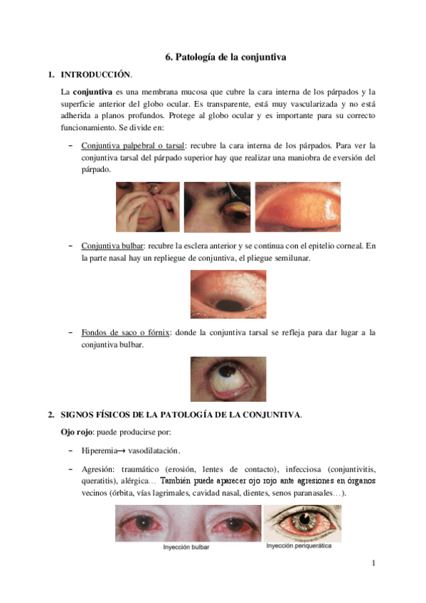 Miniatura del documento 6.-Patologia-de-la-conjuntiva.pdf
